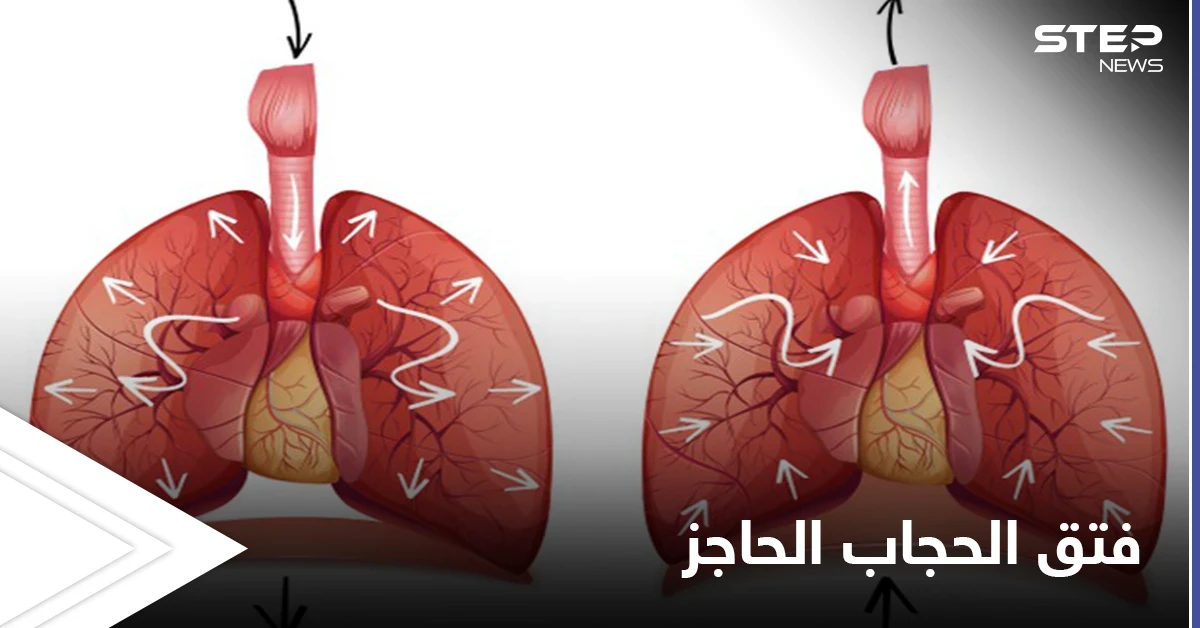 ما هي وظيفة الحجاب الحاجز وكيف يتم علاجه عن طريق العمل الجراحي إليك أهم المعلومات