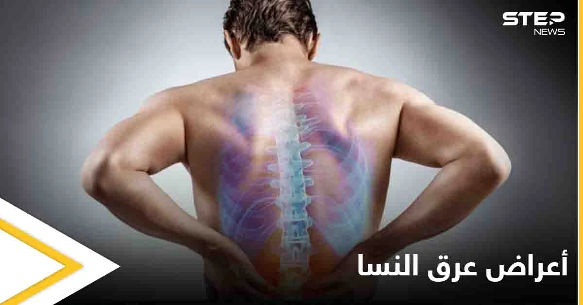 5 أعراض تخبرك بأنك مصاب بمرض عرق النسا تعرف عليها