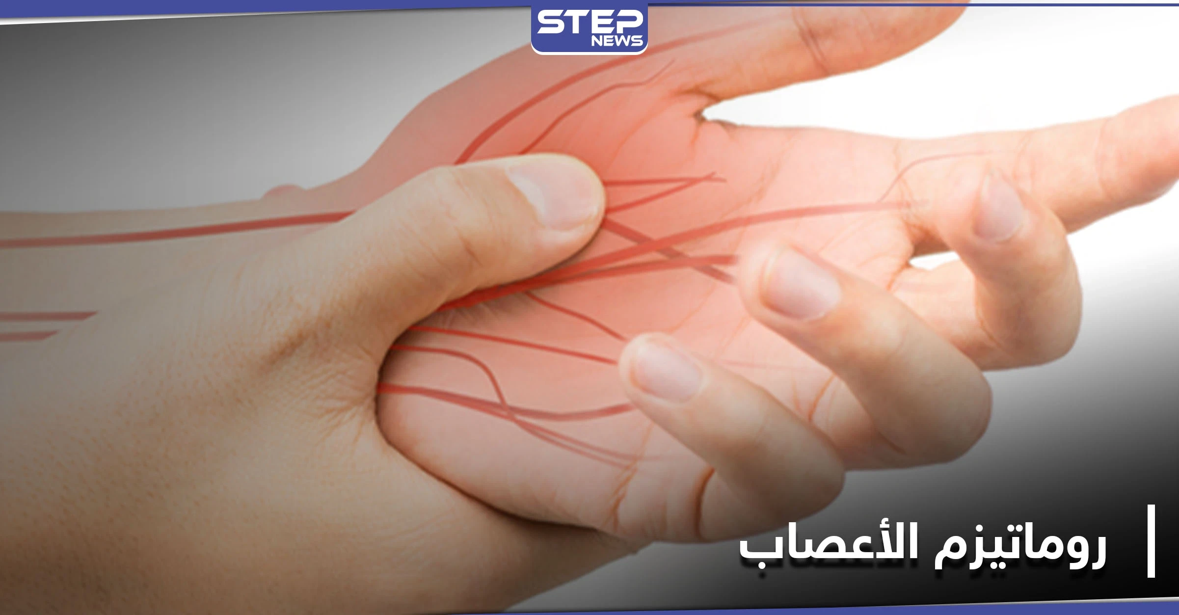 ما هو مرض روماتيزم الأعصاب.. أعراضه الــ"9" وطرق علاجه