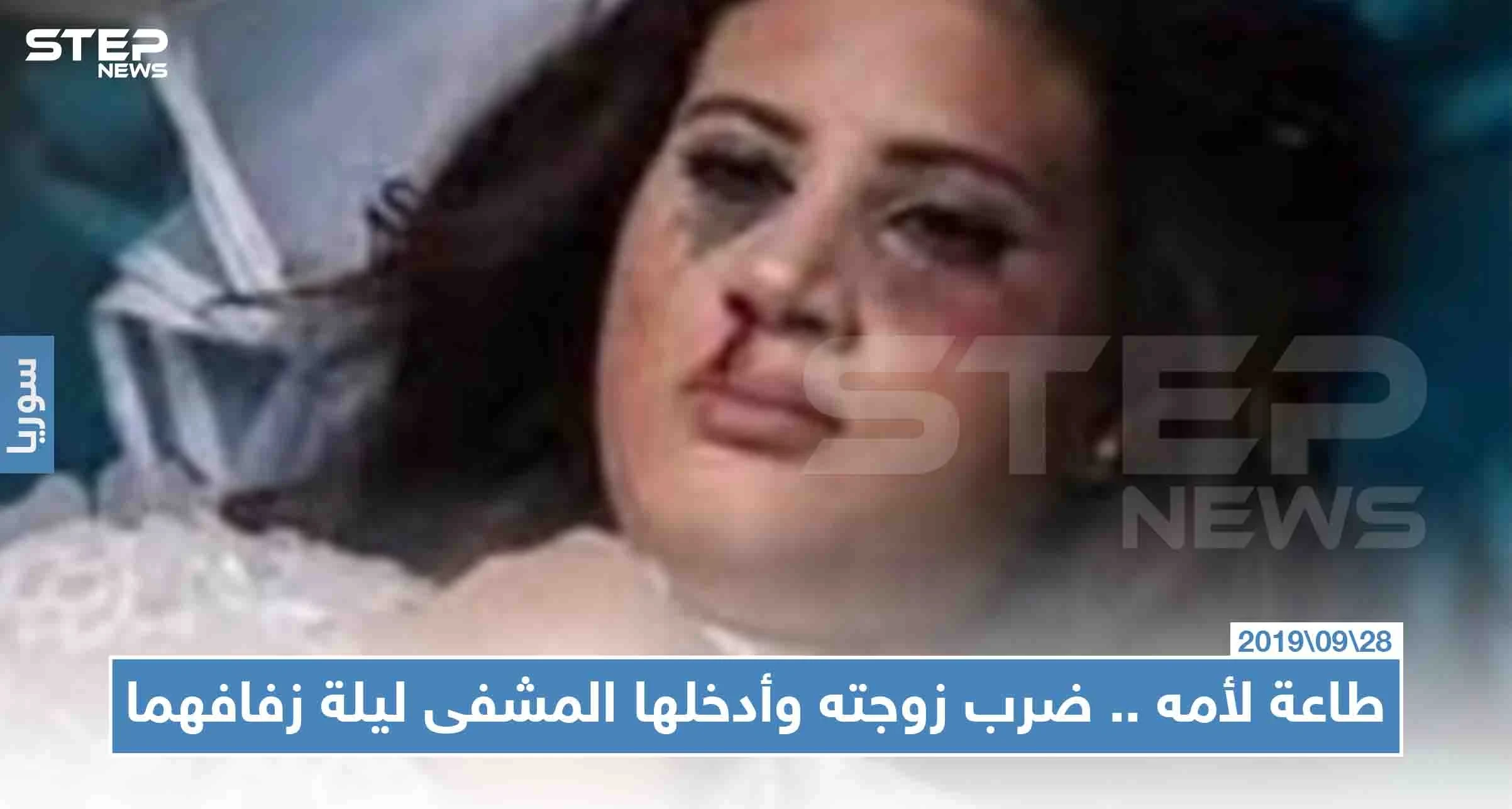 سمع كلام أمه وضرب زوجته ليلة زفافهما فأدخلها إلى العناية المركزة