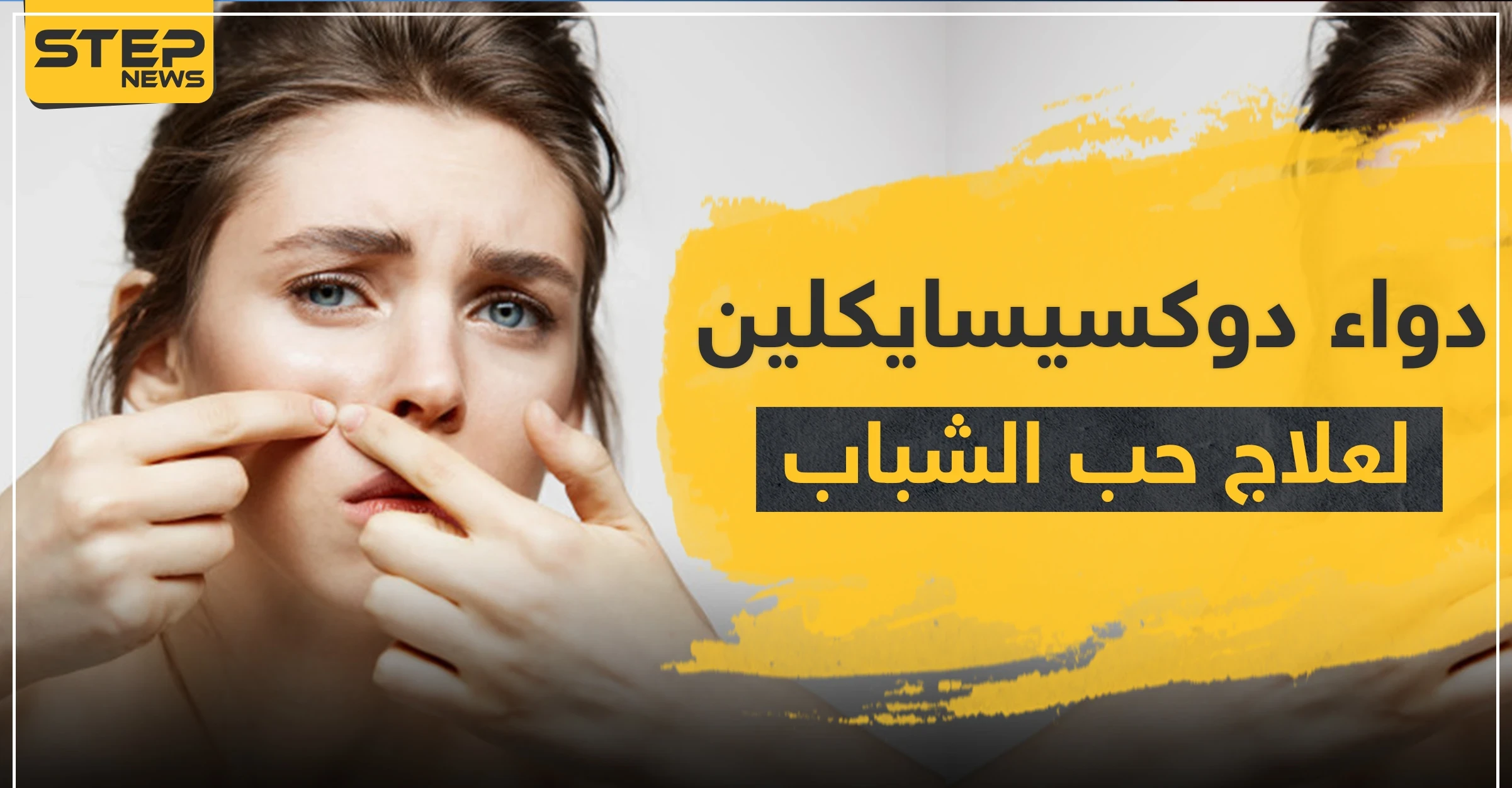 دواء doxycycline دوكسيسايكلين لعلاج حب الشباب