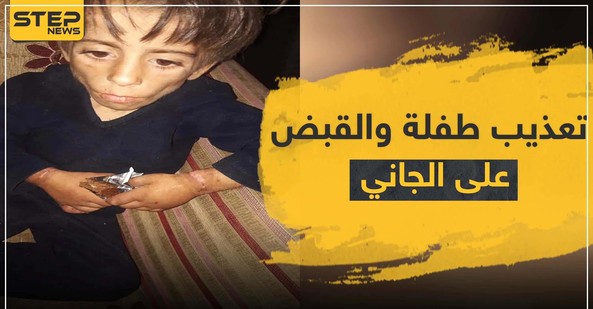 بالصور|| طفلة تتعرض لأبشع أنواع التعذيب على يد والدها والمعارضة السورية تقبض عليه