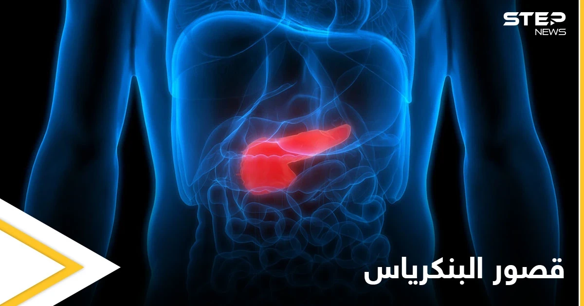 خطورة قصور البنكرياس وآثاره الصحية وطرق العلاج إليك أهم المعلومات