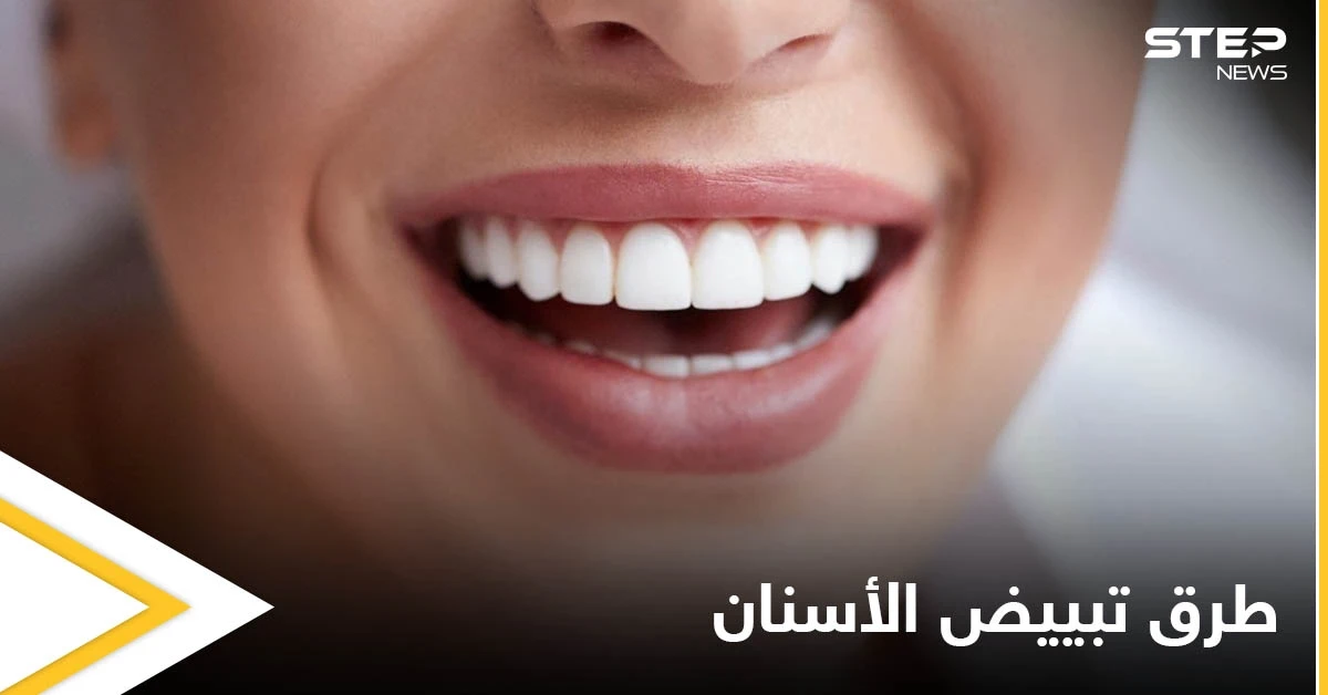 تبييض الأسنان في المنزل وأبرز أنواعه الطبية
