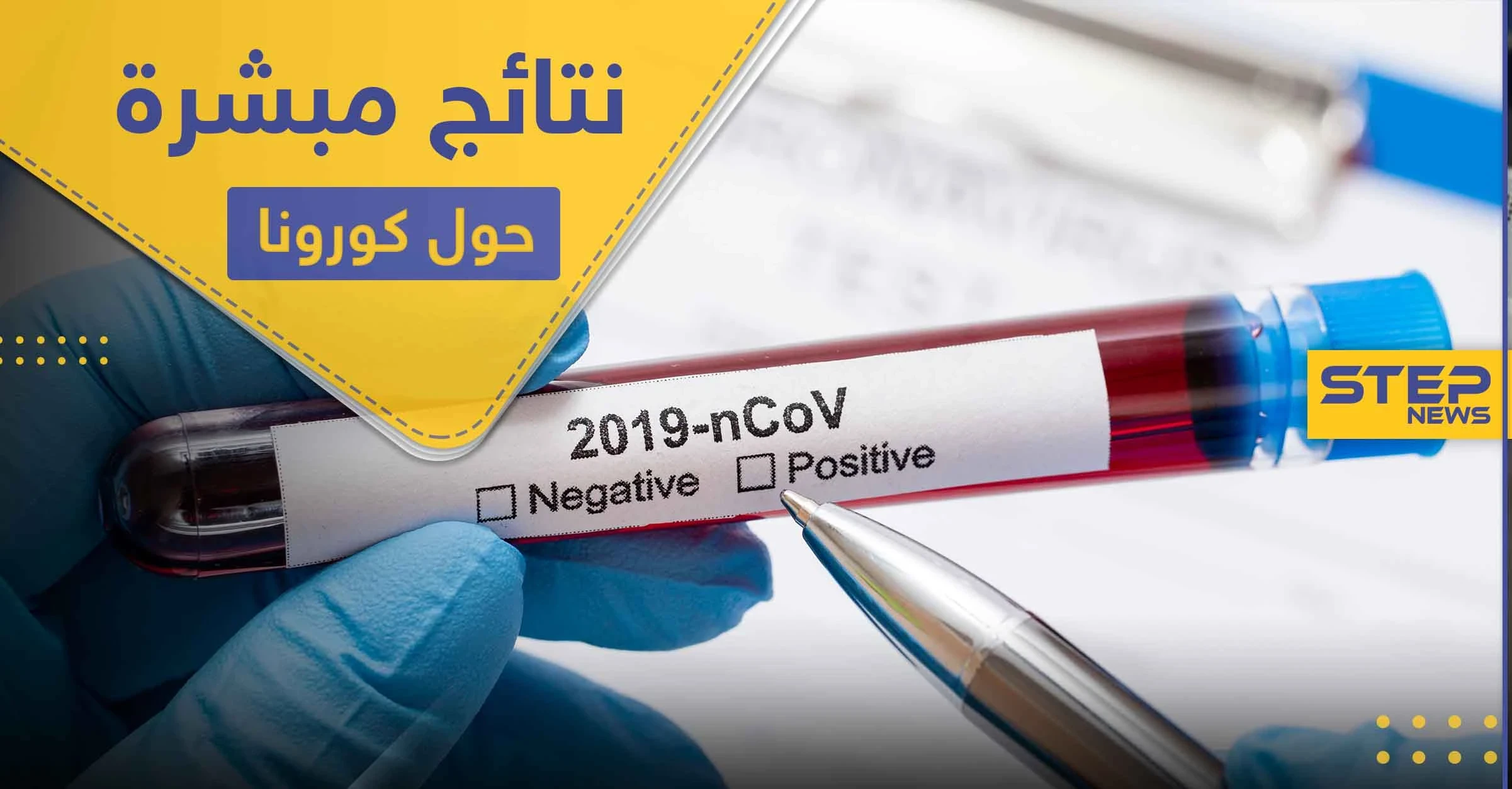 العلماء يتوصلون لنتيجة مبشرة حول كورونا .. والدواء