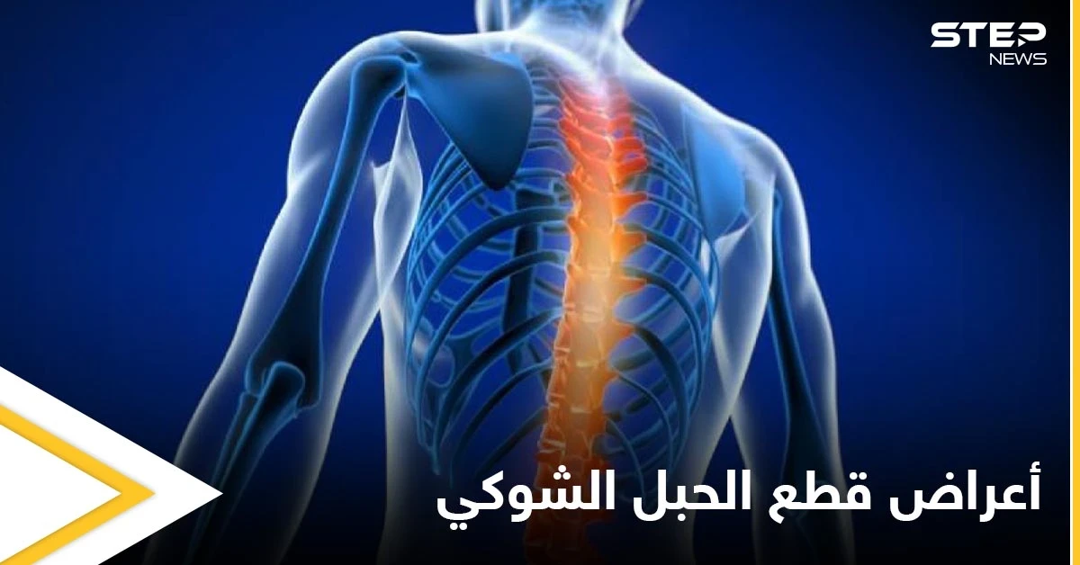 تعرف على أنواع وأعراض قطع الحبل الشوكي وطرق العلاج