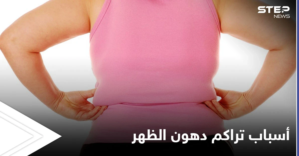 تعرف على أسباب تراكم دهون الظهر وطرق بسيطة للتخلص منها