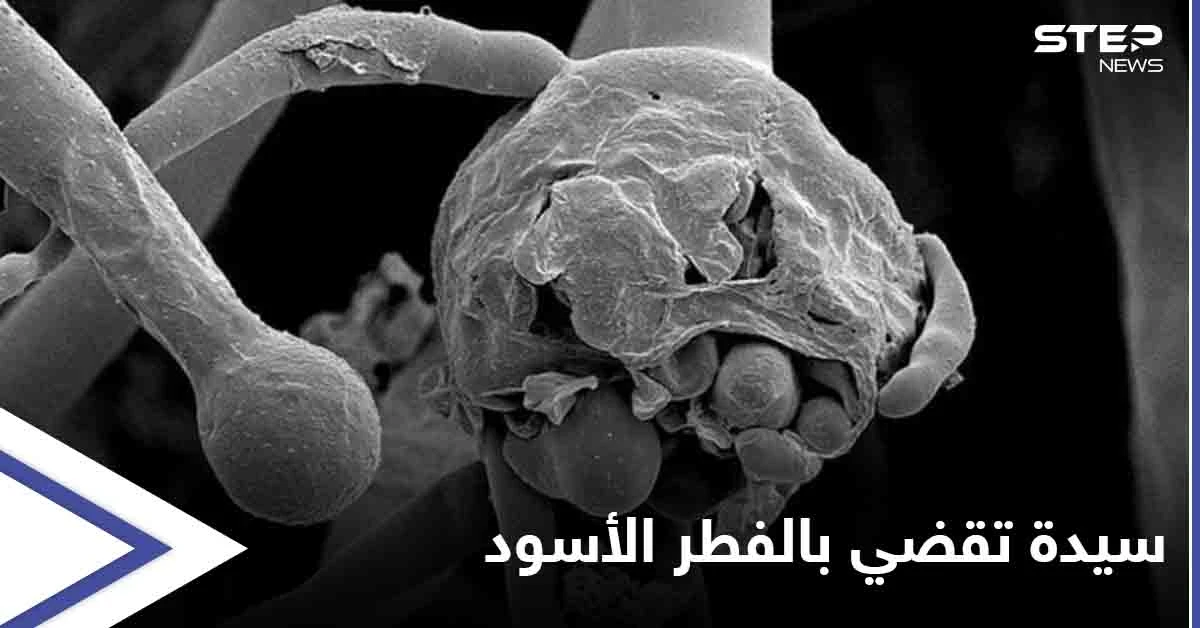 وفاة أول سيدة عربية يشتبه بإصابتها بـ الفطر الأسود