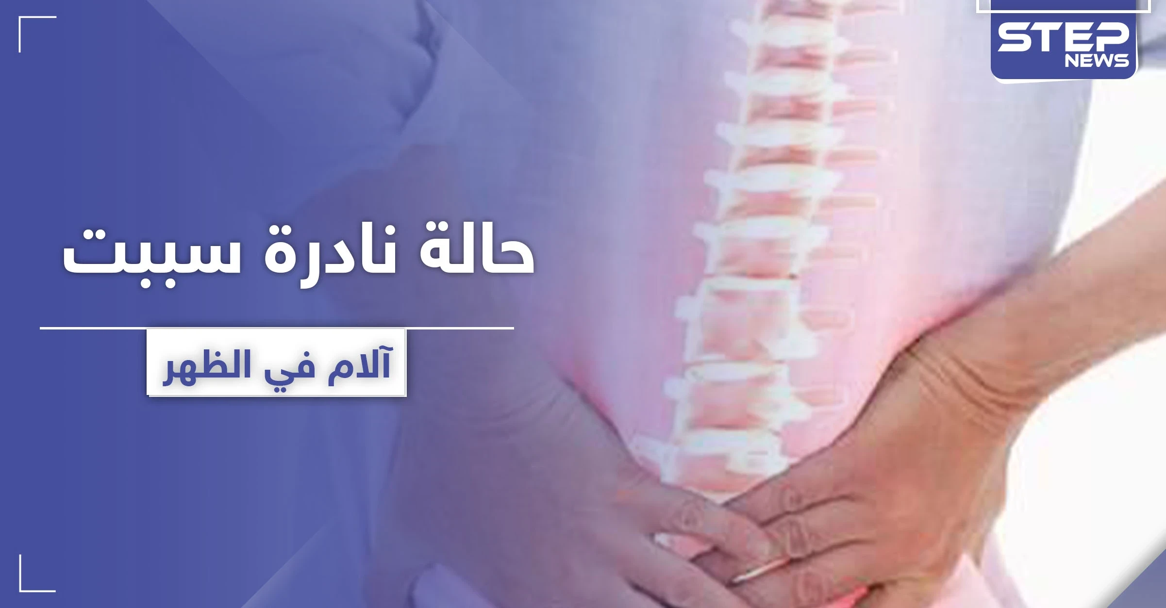 سببت آلام في الظهر.. حالة نادرة لرجل تدهش الأطباء