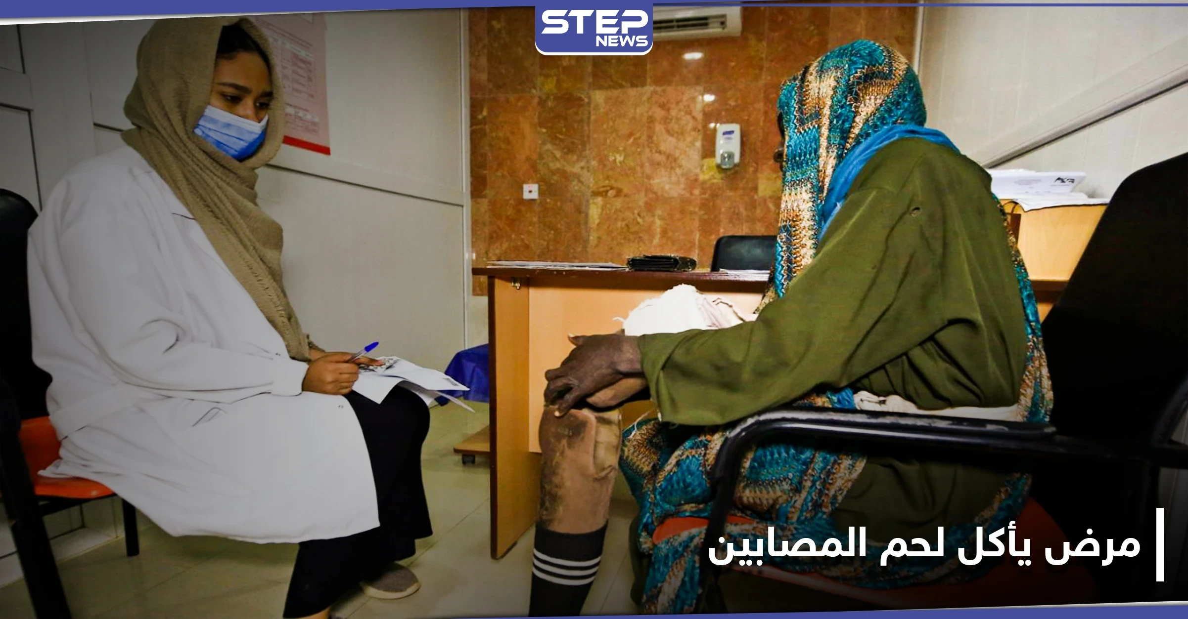 "يأكل لحم المصابين".. مرض المايستوما يتطور خلسة في السودان ويصيب الآلاف