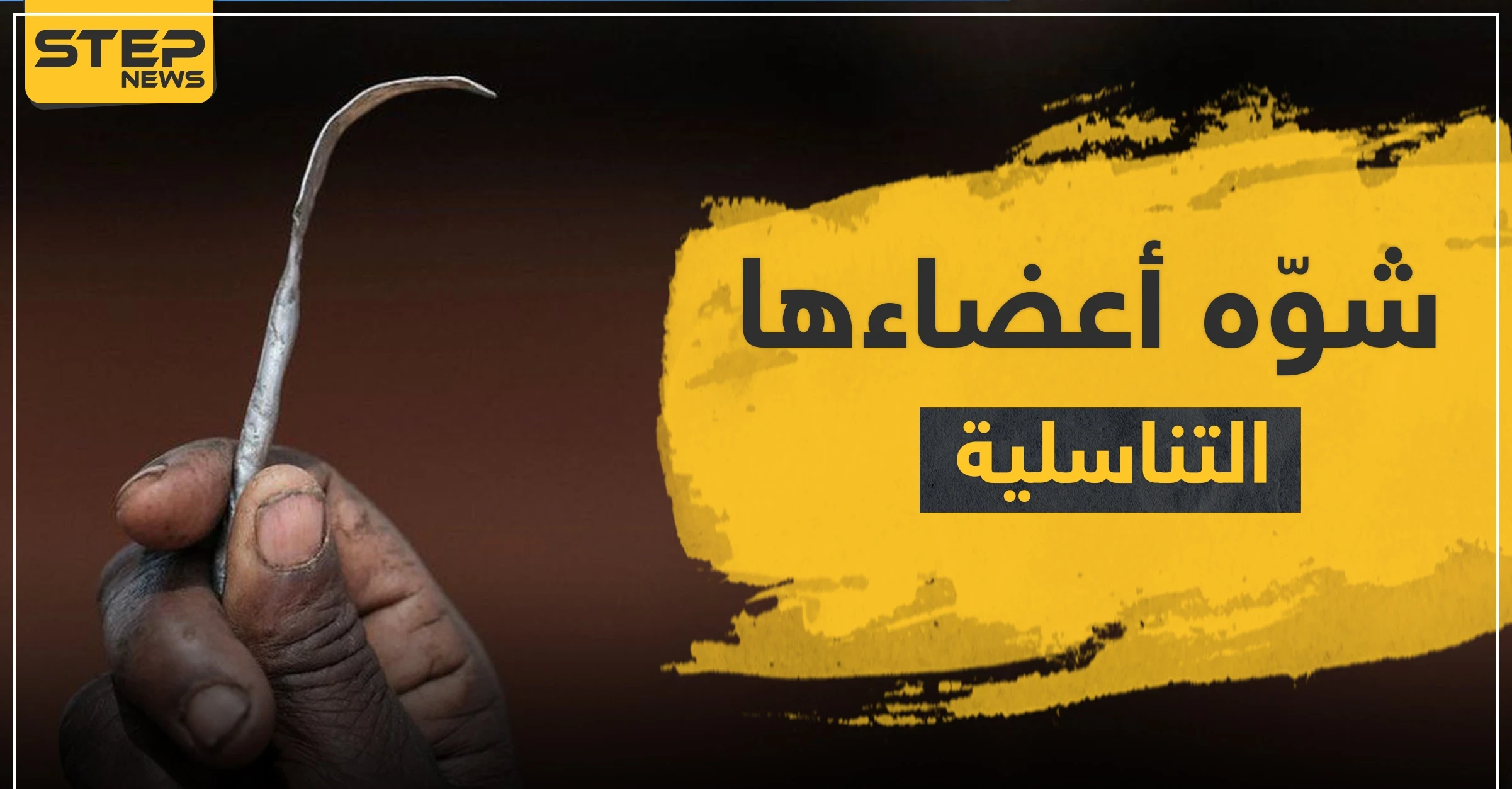 شوه أعضاءها التناسلية بعملية ختان.. طبيب مصري أمام المحكمة