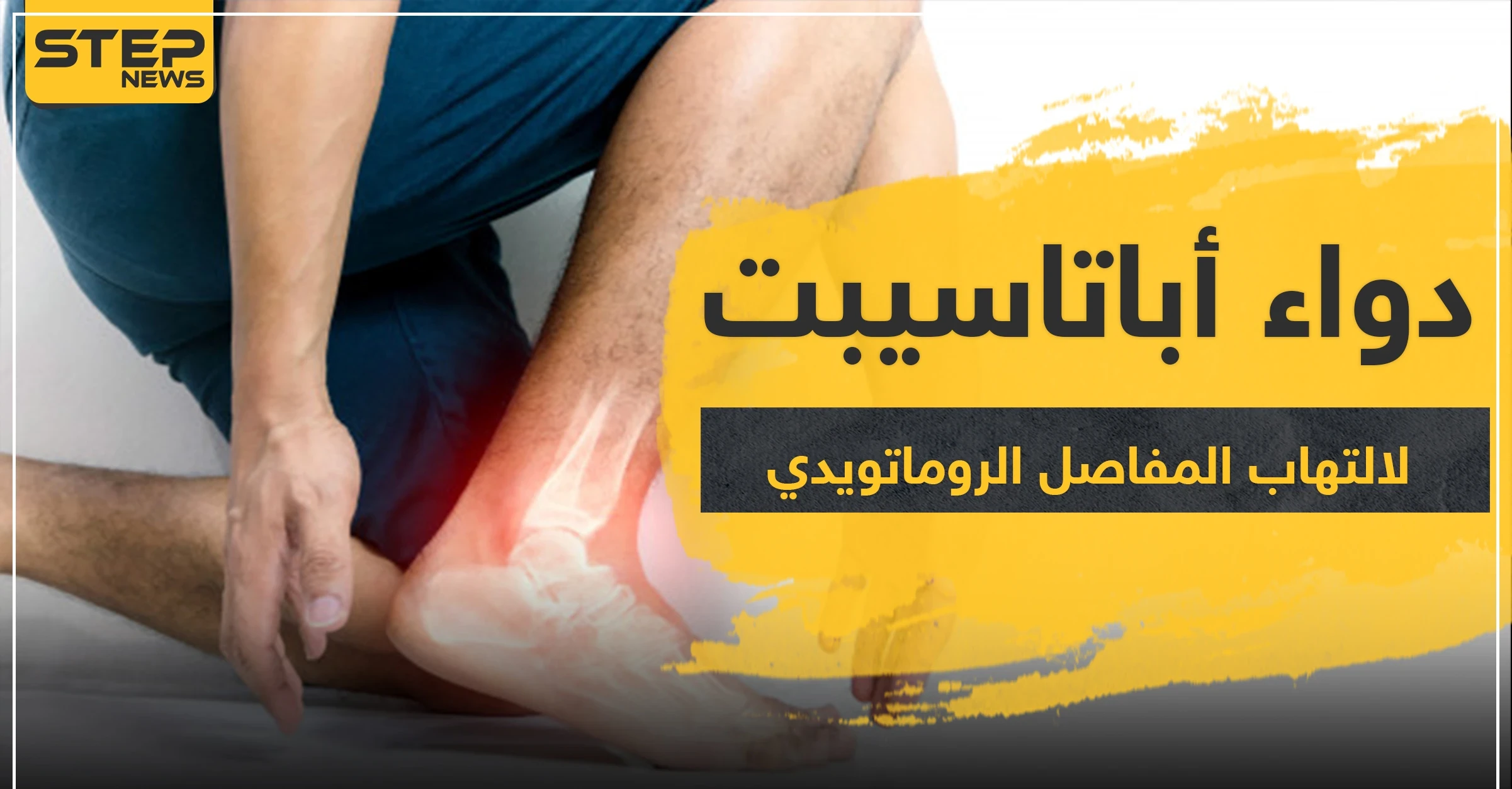 دواء أباتاسيبت لالتهاب المفاصل الروماتويدي