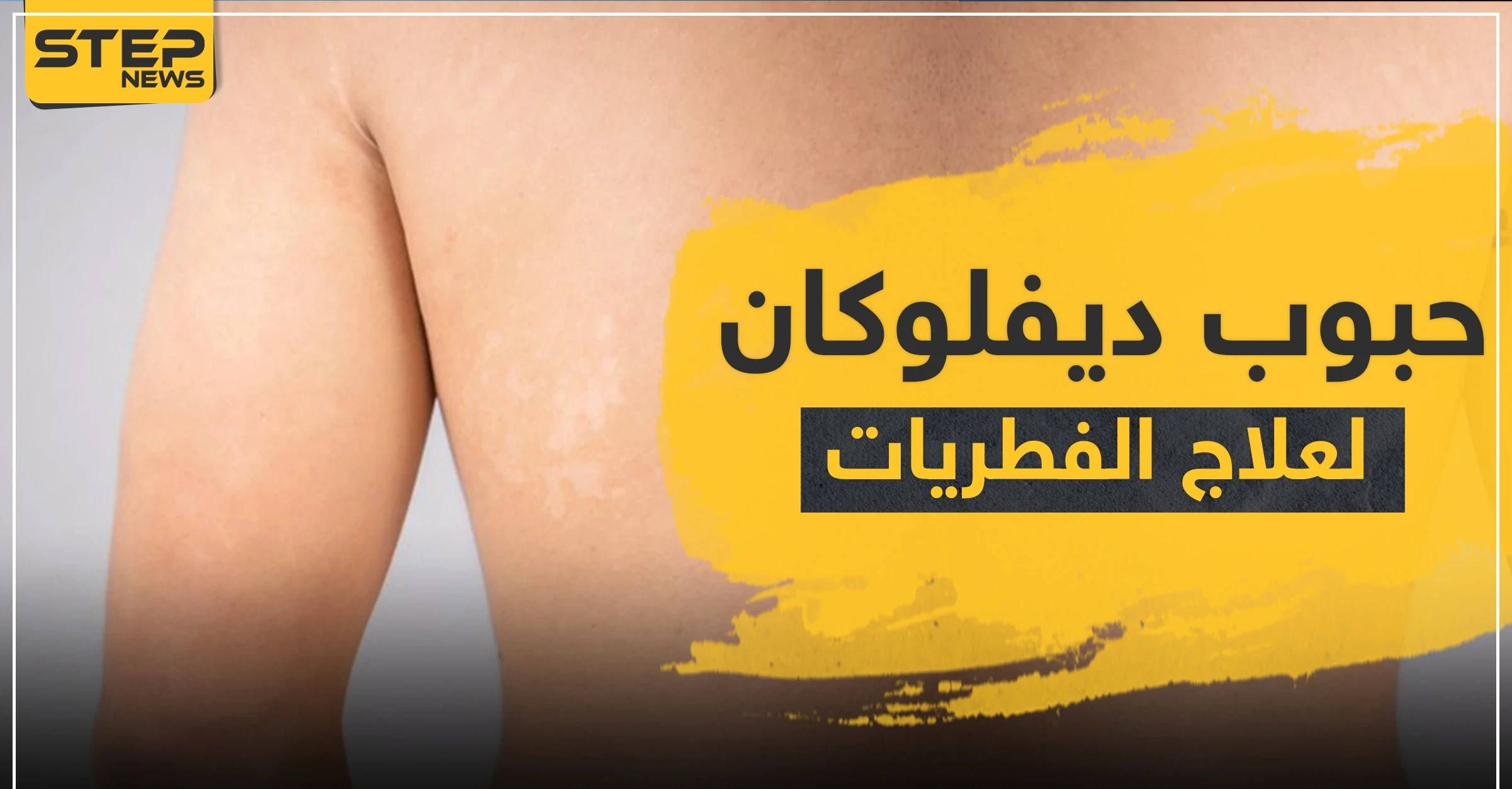 حبوب ديفلوكان لعلاج الفطريات