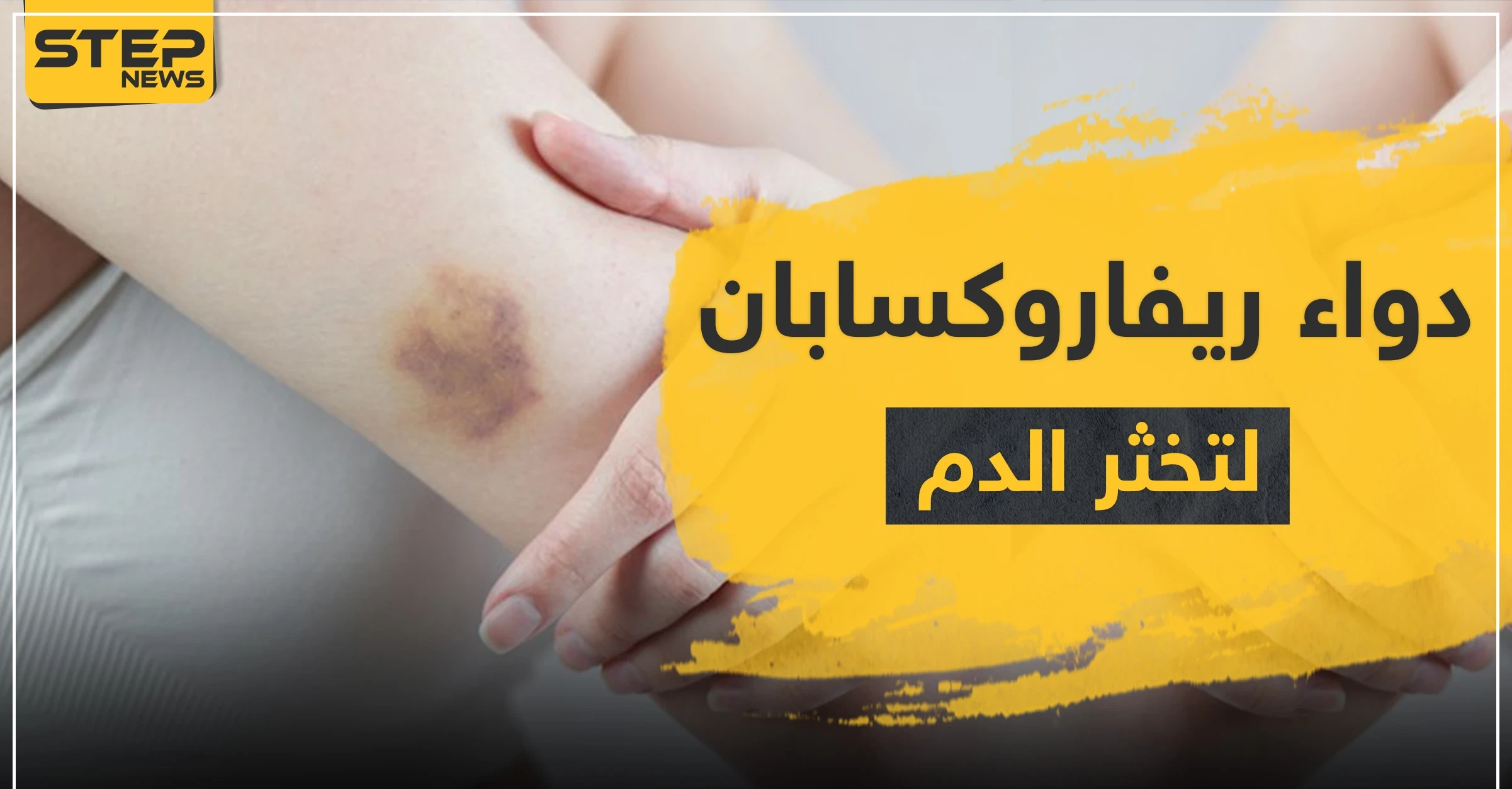 دواء ريفاروكسابان rivabosis لتخثر الدم