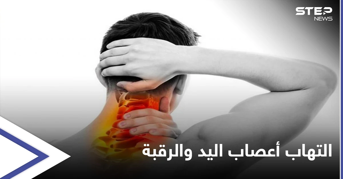 ما هو التهاب أعصاب اليد والرقبة وأفضل طرق العلاج إليك أهم المعلومات