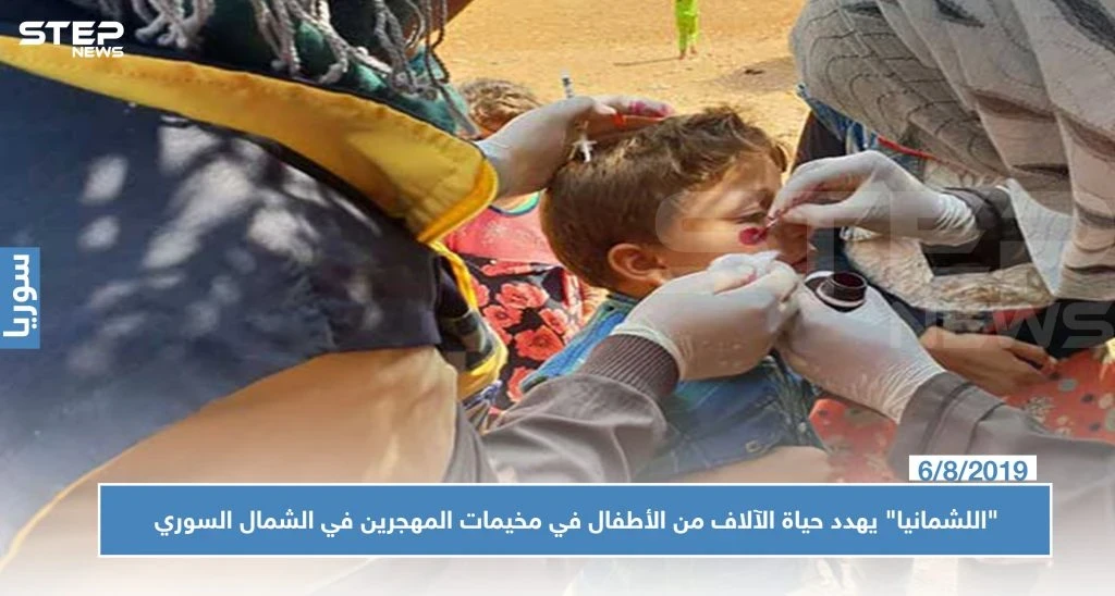 "اللشمانيا" يهدد حياة الآلاف من الأطفال في مخيمات المهجرين في الشمال السوري