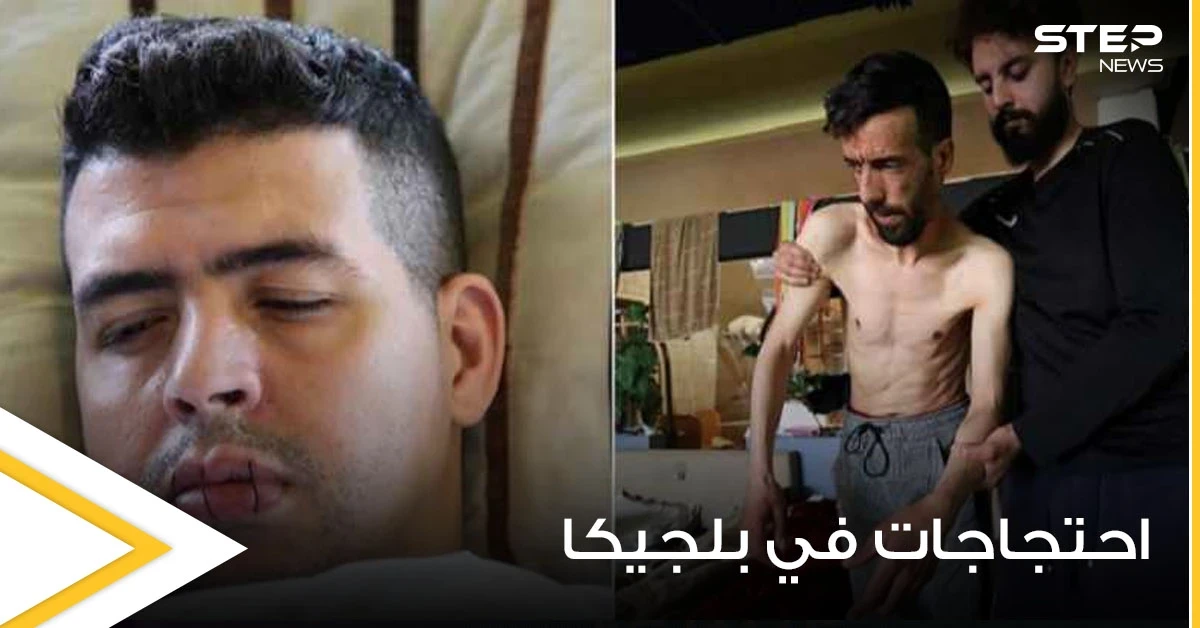 بالصور|| لاجئون في بلجيكا يخيطون أفواههم للإضراب عن الطعام احتجاجاً على أوضاعهم