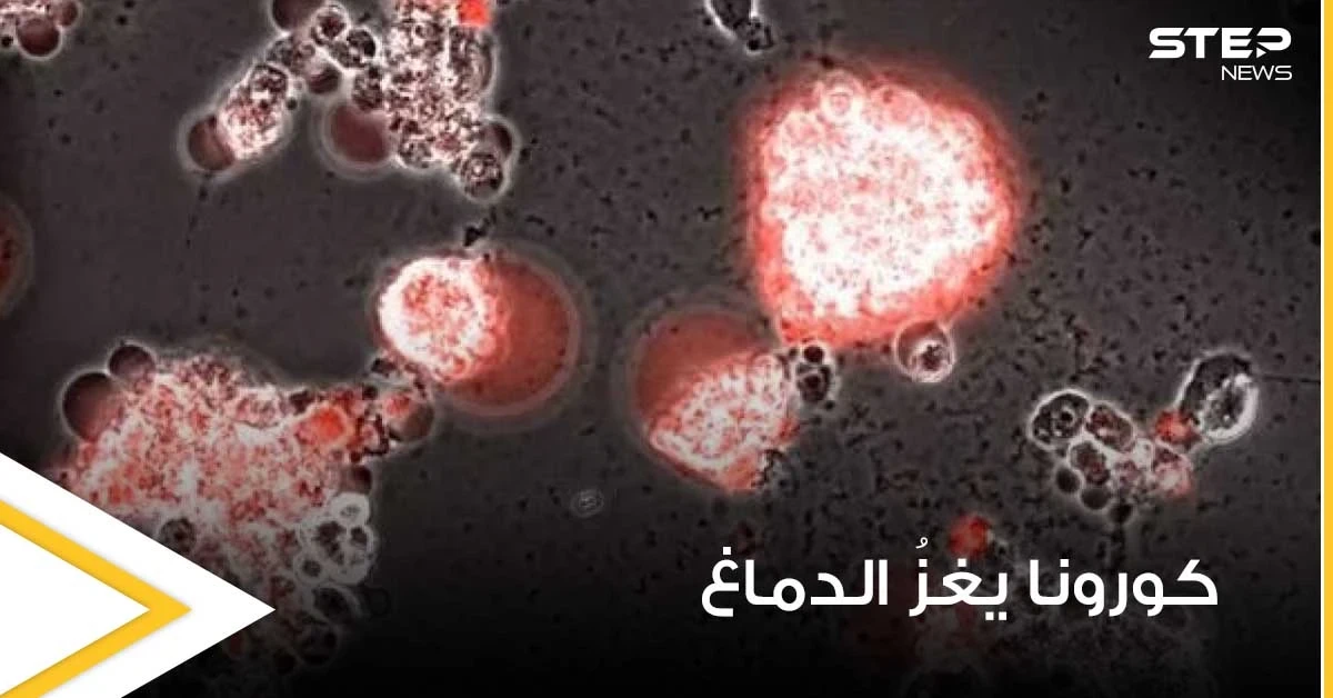 بالفيديو|| في تصوير نادر.. فيديو يوثق كيف يغزو فيروس كورونا خلايا الدماغ