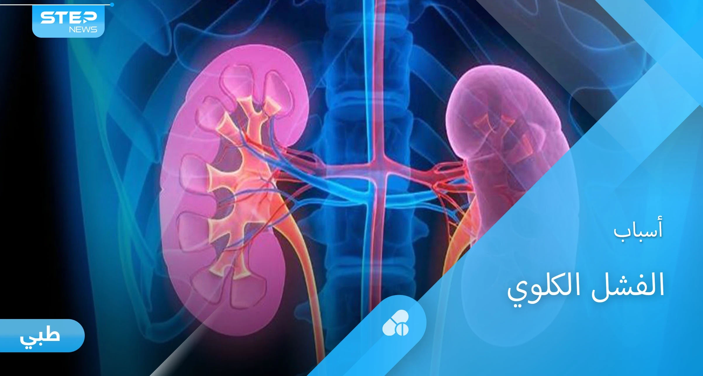 أسباب الفشل الكلوي المزمن وأفضل طرق العلاج إليك أهم المعلومات