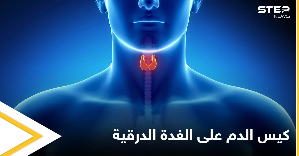 ما هي مخاطر وجود كيس الدم على الغدة الدرقية وأعراضه وطرق العلاج إليك أهم المعلومات