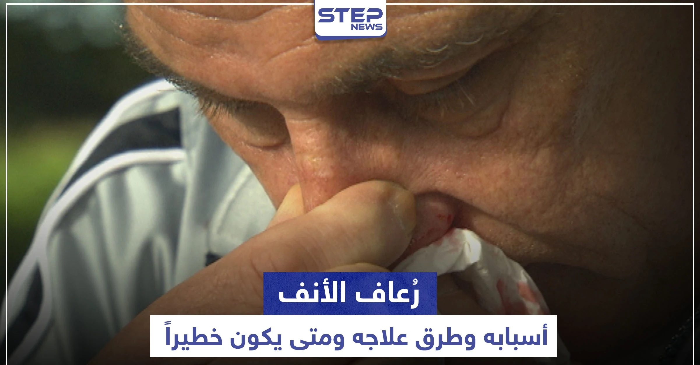 متى يكون رُعاف الأنف خطيراً .. أسبابه وطرق علاجه