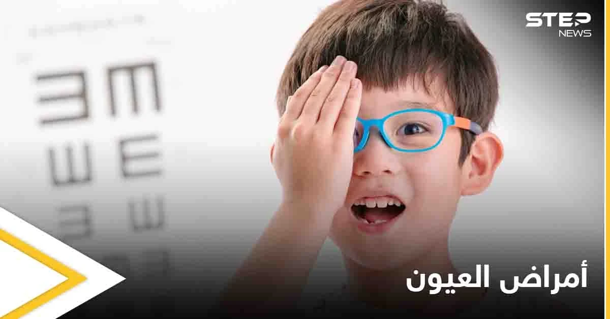 تعرف على أمراض العيون الشائعة لدى الأطفال في المراحل المبكرة وطرق علاجها