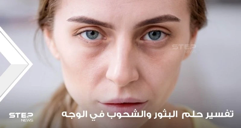 تفسير رؤية البثور والشحوب في المنام في الوجه وفي جميع أنحاء الجسم
