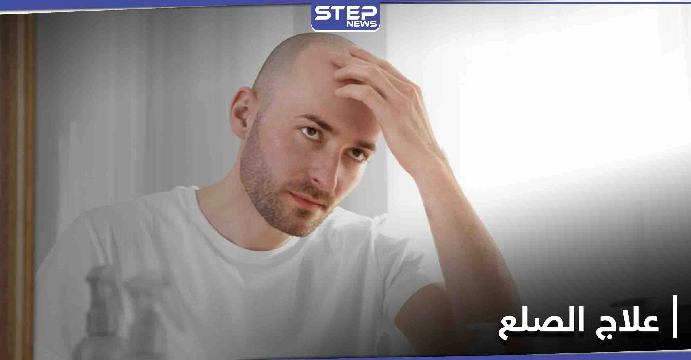 تمهيداً لعلاج الصلع.. العلماء يكشفون السبب الذي يثبّط نشاط بصيلات الشعر