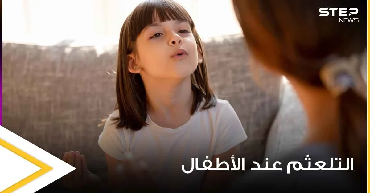 التلعثم عند الأطفال "التأتأة".. ما أسبابه وما هي طرق علاجه