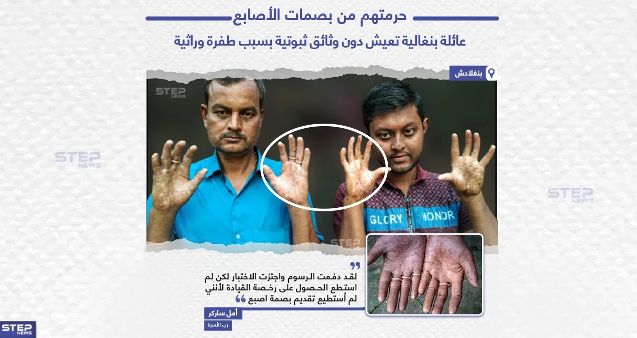 عائلة بنغالية تعيش دون وثائق ثبوتية بسبب طفرة وراثية