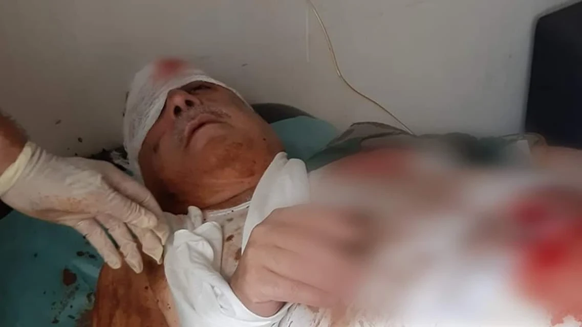 إصابة المسؤول الأول عن مجزرة البيضا بجراح بالغة نتيجة عبوة ناسفة!!
