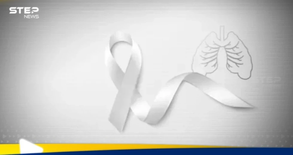 دراسة علمية تكشف سر انتشار سرطان الرئة لدى غير المدخنين