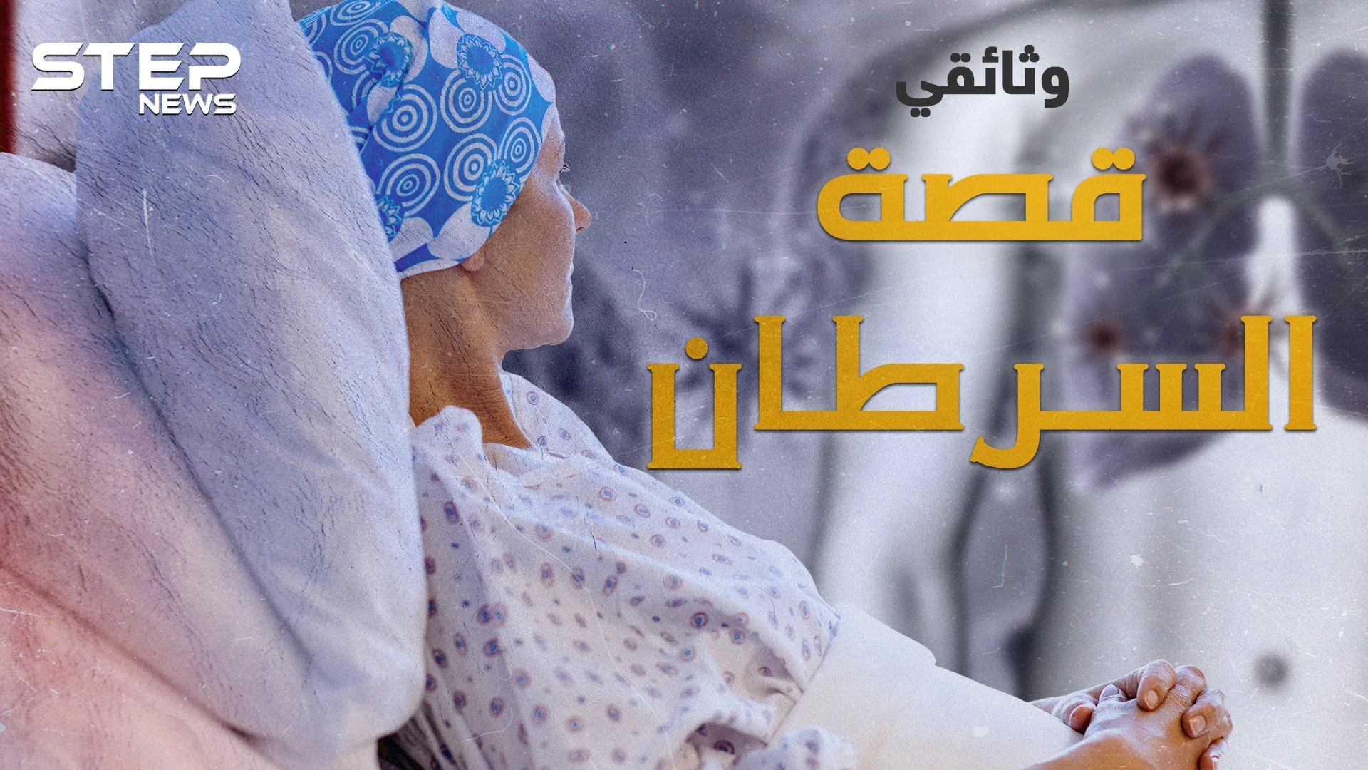 مرض السرطان.. في يومه العالمي ما هي قصة ظهوره قبل آلاف الأعوام وحتى الآن
