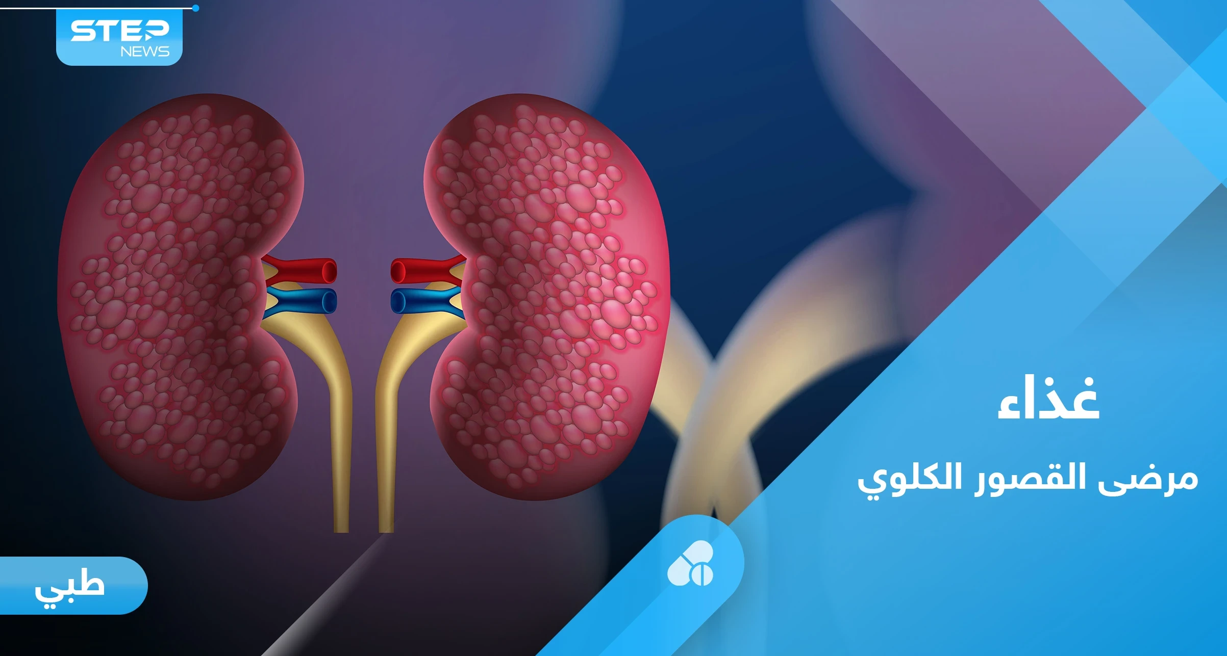القصور الكلوي.. إليك النظام الغذائي الأمثل لتجنب تفاقم المرض