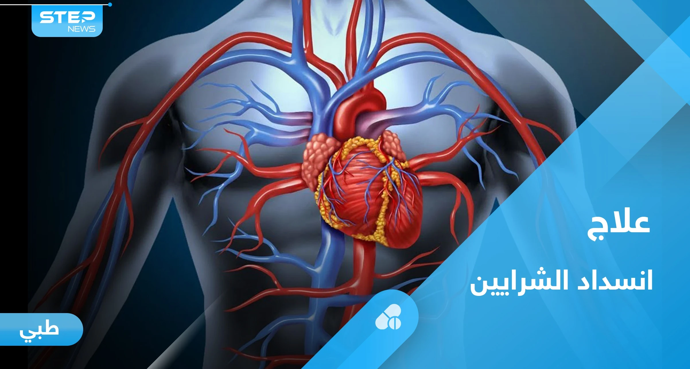 علاج انسداد الشرايين والأوعية الدموية بوسائل طبيعية