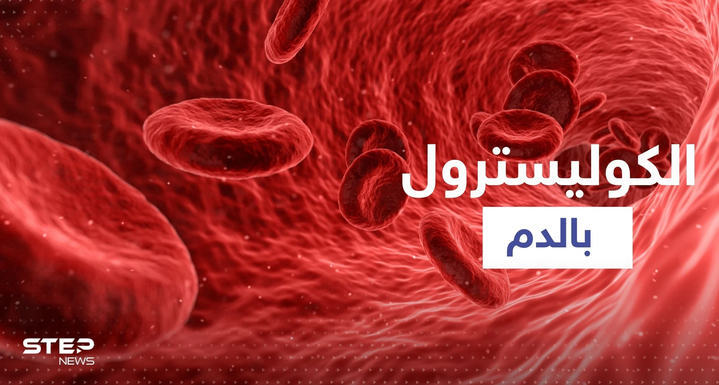 "تصيب الساق ويمكن أن تكون خطيرة".. أول علامة لارتفاع نسبة الكوليسترول