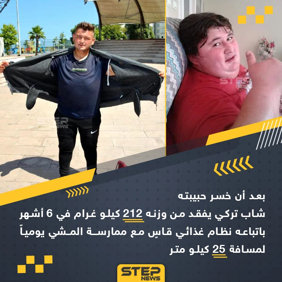 شاب تركي يخسر 212 كغ من وزنه باتباع نظام غذائي قاسِ