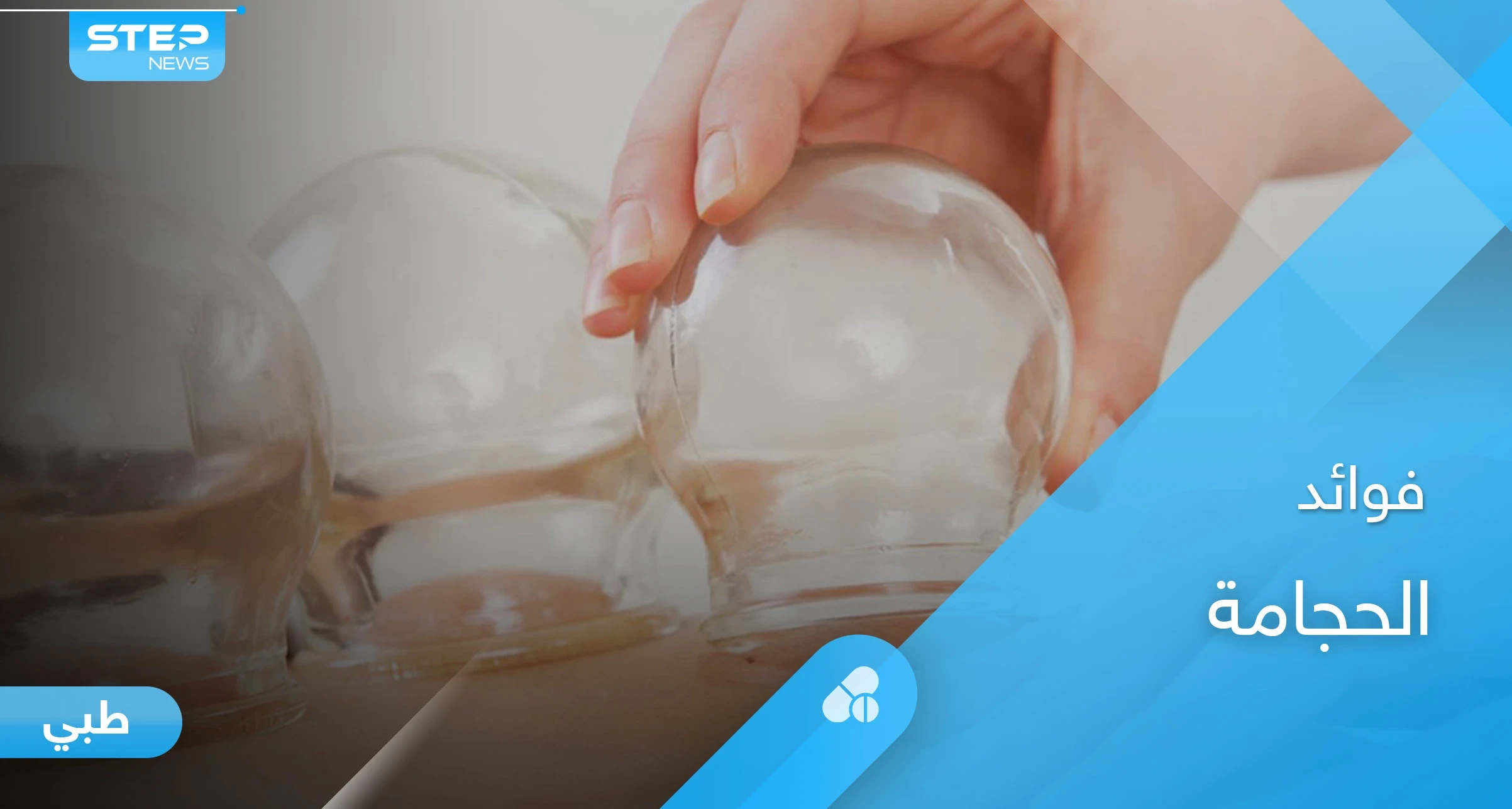 أنواع الحجامة وفوائدها لعلاج الأمراض ونصائح ما بعد الحجامة