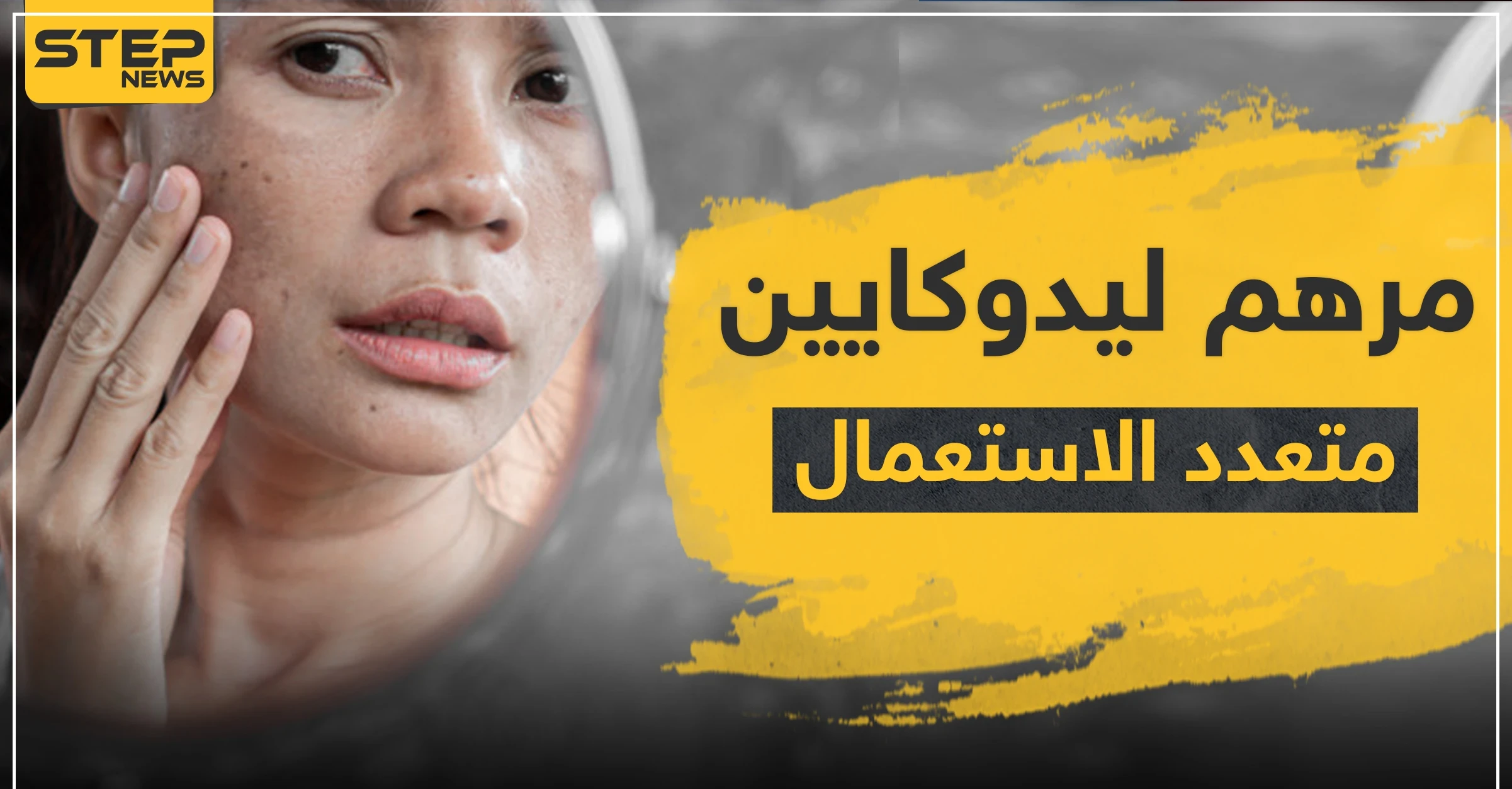مرهم ليدوكايين متعدد الاستعمال