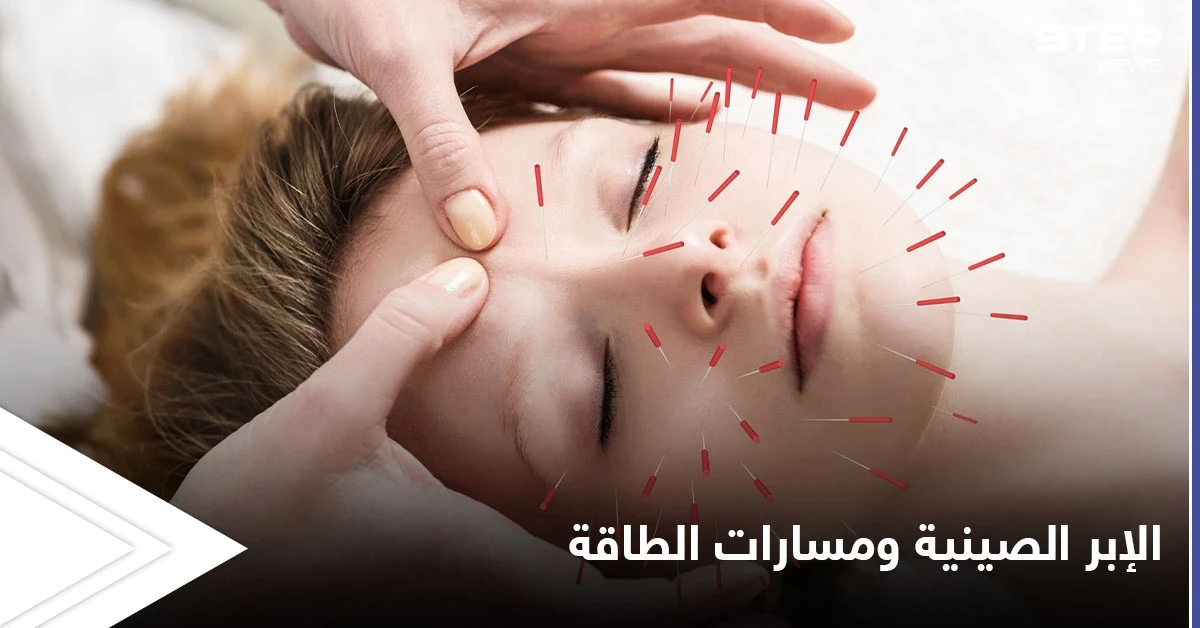 العلاج عن طريق الوخز بالإبر ومسارات الطاقة.. أسرار الطريقة الصينية المتبعة منذ القدم