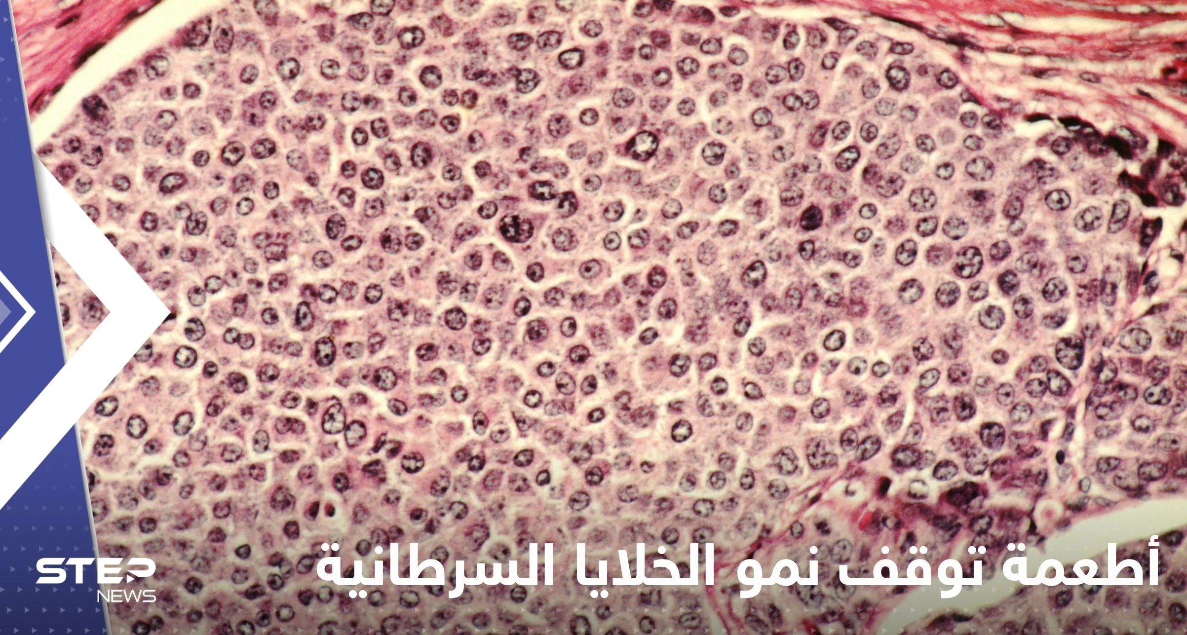علماء يكتشفون أطعمة توقف نمو الخلايا السرطانية في الجسم وتمنع انتشارها