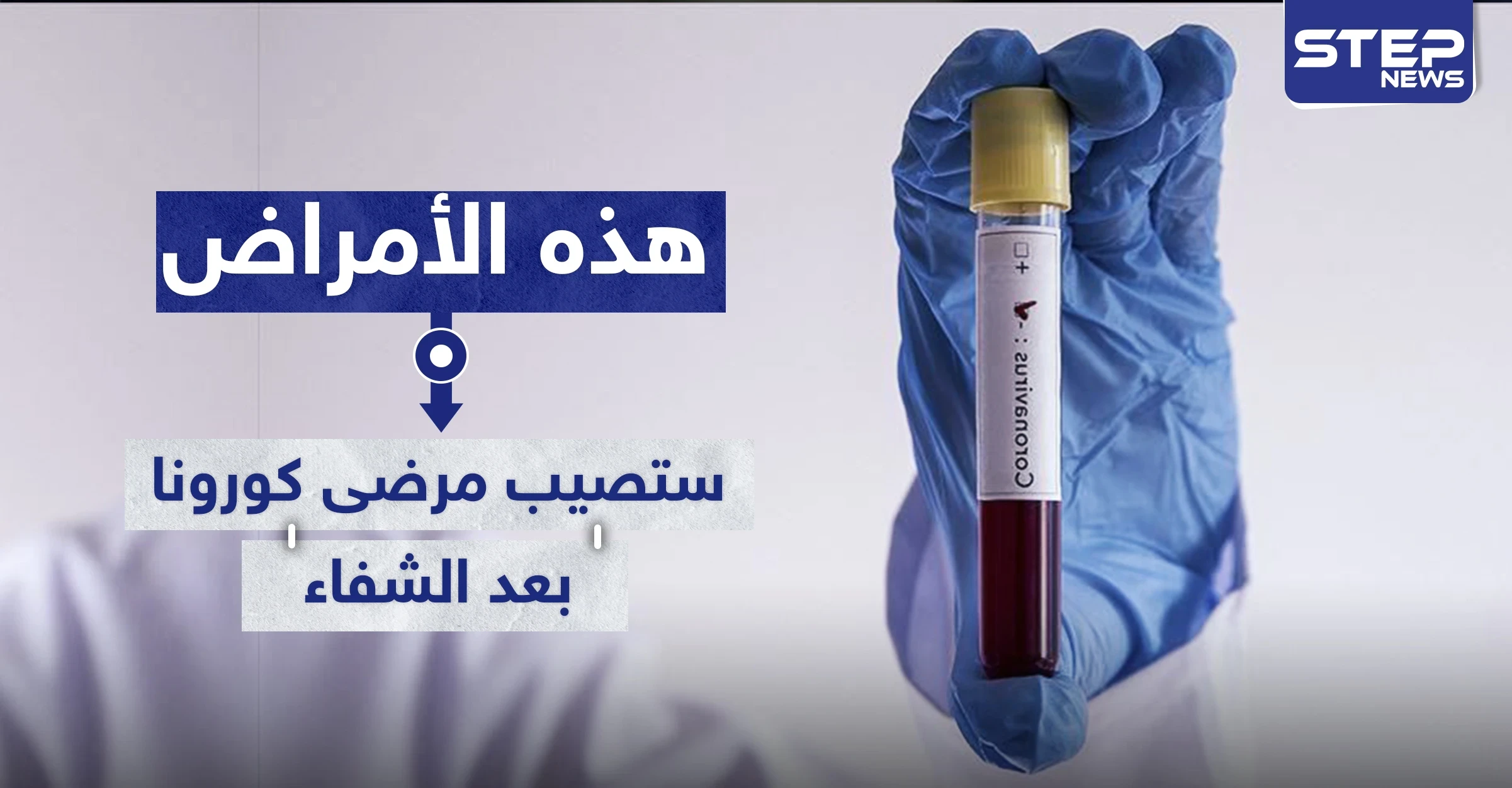 دراسة تكشف الأمراض التي ستصيب مرضى "كورونا" بعد الشفاء من الفيروس