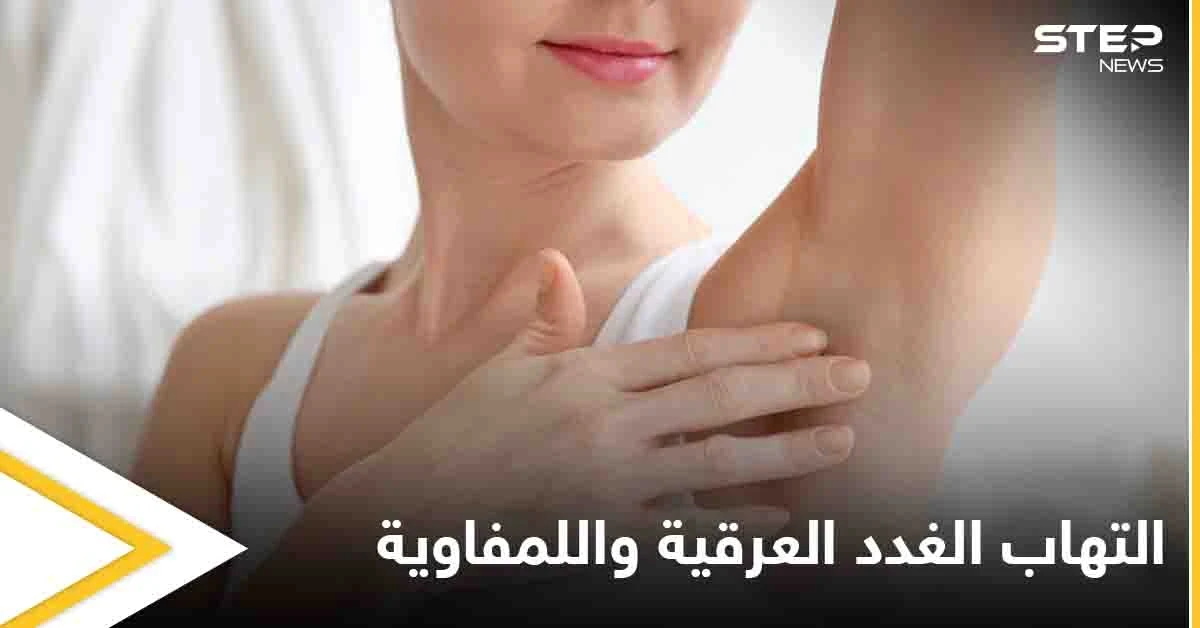 تعرف على أسباب التهاب الغدد العرقية واللمفاوية والفرق بينهما