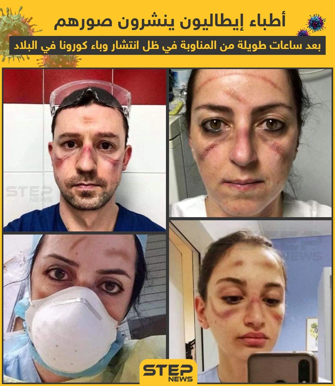 أطباء إيطاليون بعد ساعات طويلة من علاج مصابي كورونا