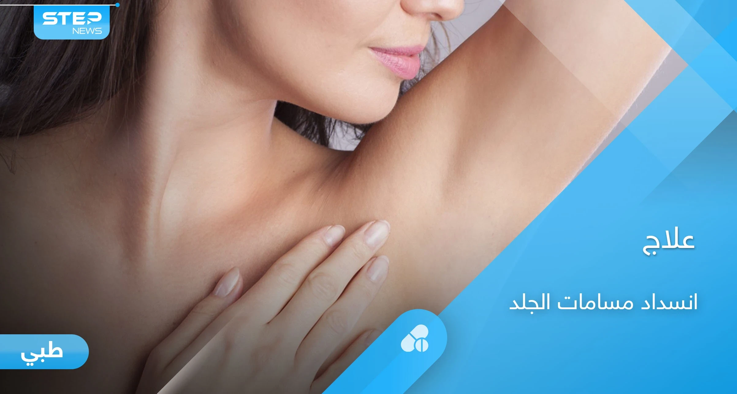 علاج انسداد مسامات العرق ومضاعفاتها المزعجة بطرق بسيطة