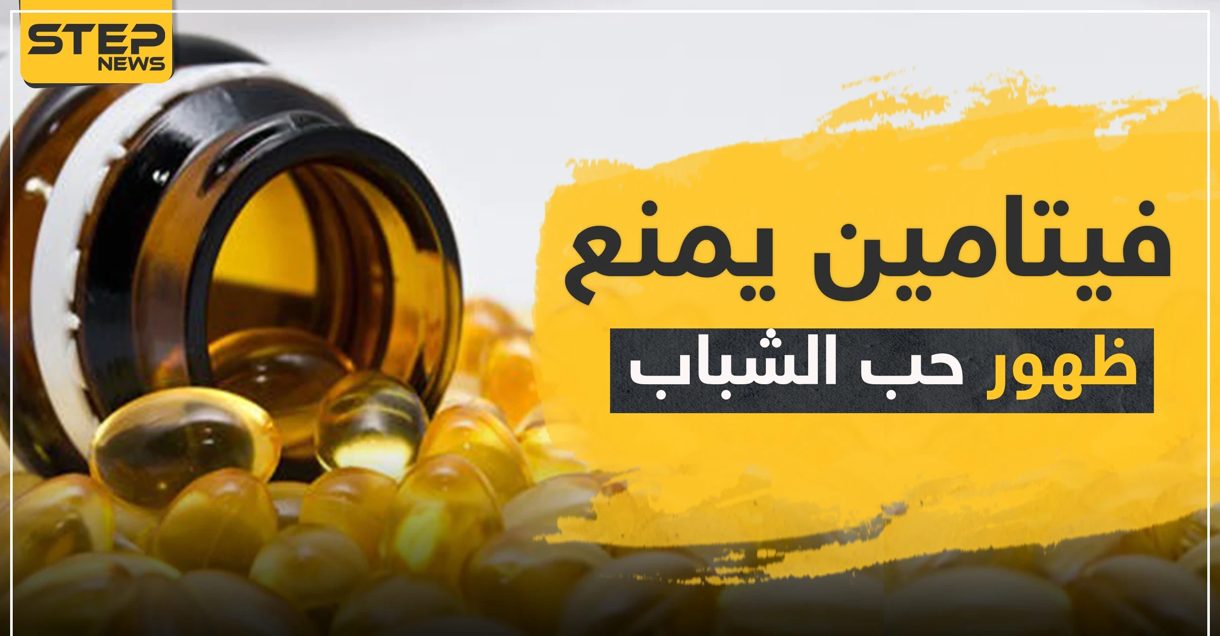 إذا كنت تعاني منها.. فيتامين يمنع ظهور حب الشباب