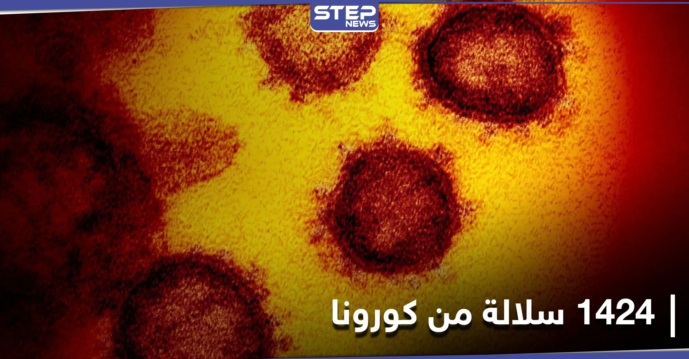 روسيا تكشف عن رصد 1424 سلالة من فيروس كورونا في البلاد