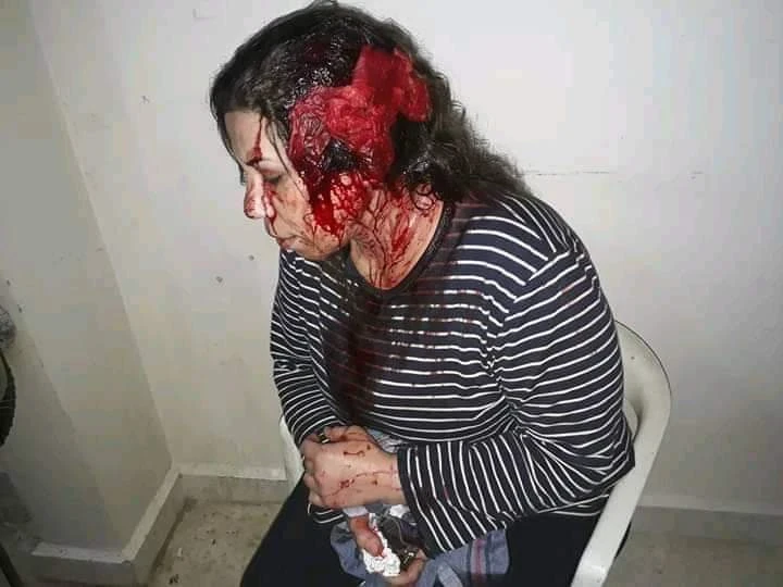 ميليشيا "قسد" تعتقل عدداً من الناشطين وتعتدي بالضرب على أحد رموز الثورة في الرقة!!