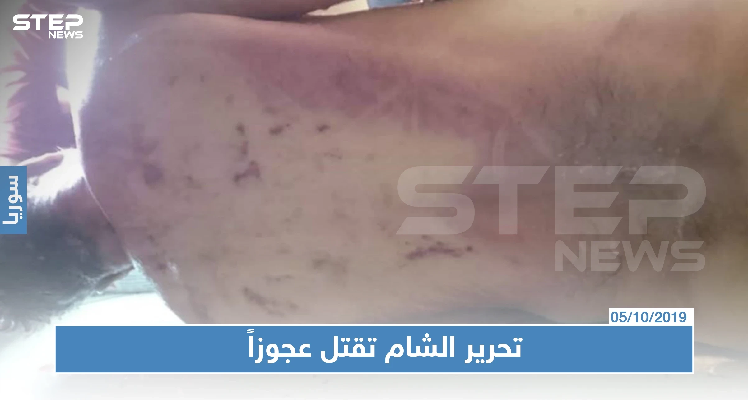 بالصور: مقتل رجل تحت التعذيب بسجون هيئة تحرير الشام