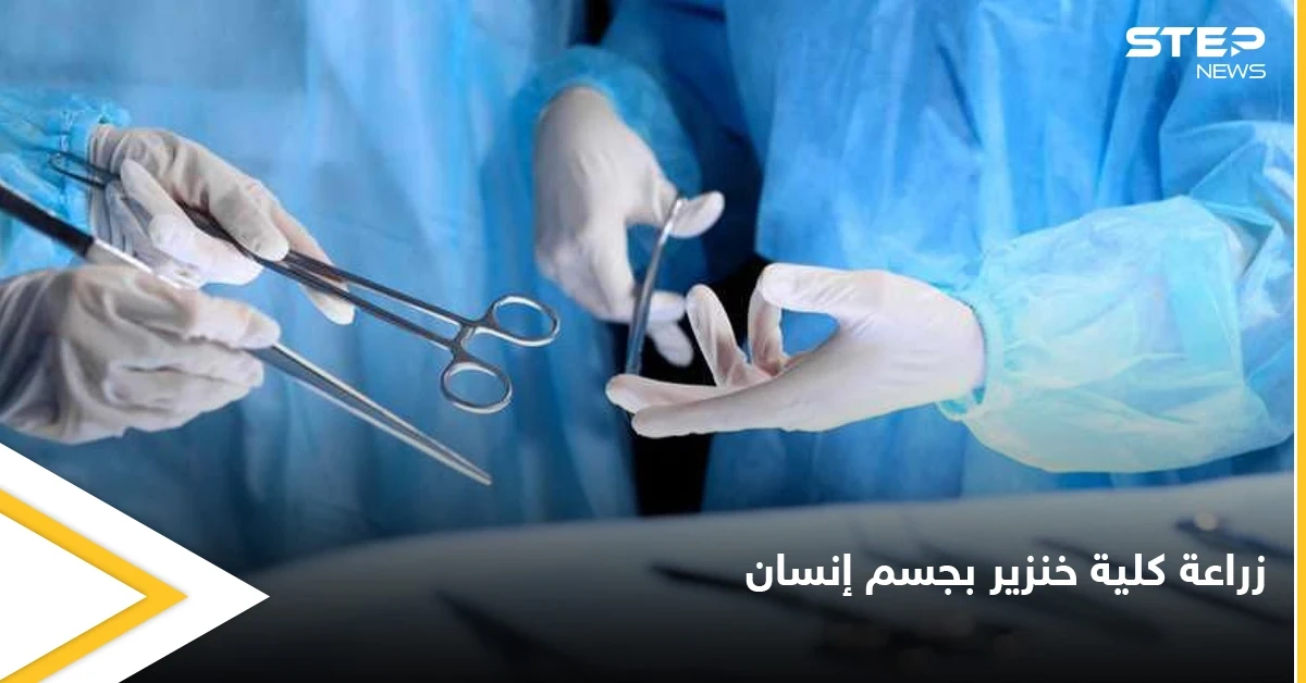 تجارة الأعضاء البشرية إلى زوال بعد نجاح زراعة كلية خنزير في جسم إنسان لأول مرة في التاريخ